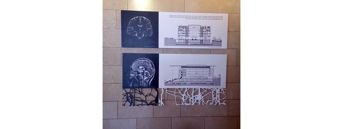 פוטנציאל -> פעולה